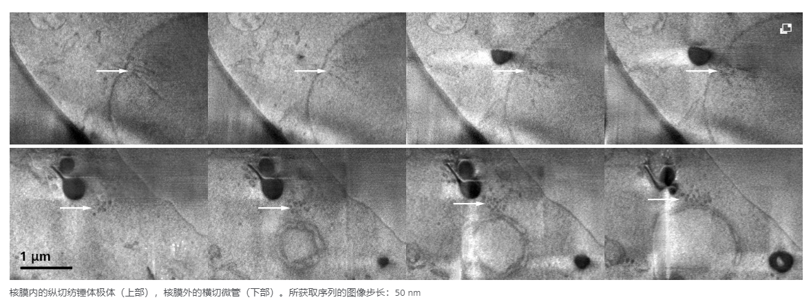 冷冻TEM薄片制备和冷冻体积成像的解决方案-13.png